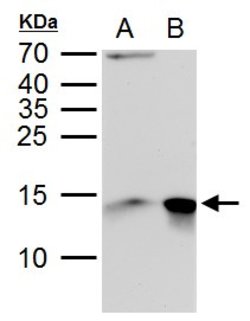 Invitrogen Galectin 1 Polyclonal Antibody 100 &mu;L; Unconjugated:Antibodies,