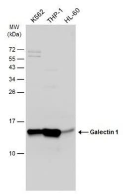 Invitrogen Galectin 1 Polyclonal Antibody 100 &mu;L; Unconjugated:Antibodies,