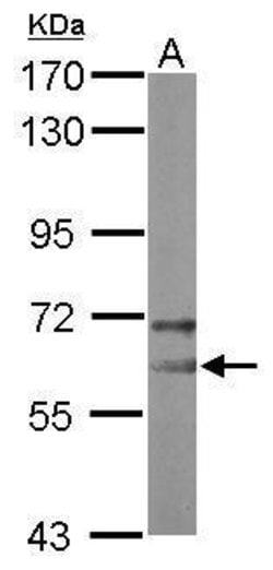 Invitrogen NOP58 Polyclonal Antibody 100 &mu;L; Unconjugated:Antibodies,
