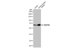 Invitrogen NOP58 Polyclonal Antibody 100 &mu;L; Unconjugated:Antibodies,
