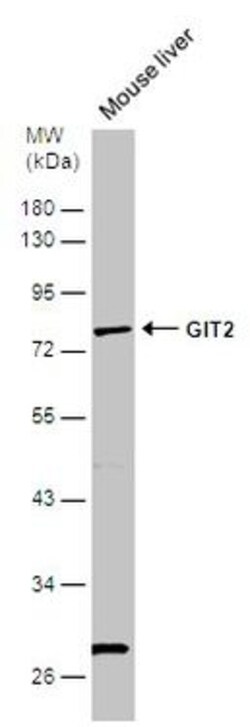 Invitrogen GIT2 Polyclonal Antibody 100 &mu;L | Buy Online | Invitrogen&trade; | Fisher Scientific