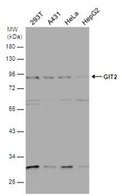 Invitrogen GIT2 Polyclonal Antibody 100 &mu;L | Buy Online | Invitrogen&trade; | Fisher Scientific