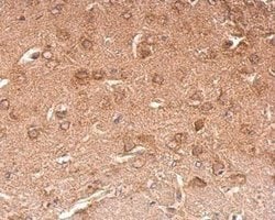 Invitrogen™ Chromogranin C Polyclonal Antibody