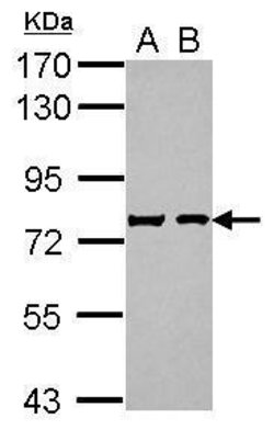 Invitrogen Chromogranin C Polyclonal Antibody 100 &mu;L; Unconjugated:Antikörper