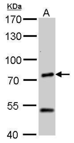 Invitrogen Chromogranin C Polyclonal Antibody 100 &mu;L; Unconjugated:Antikörper