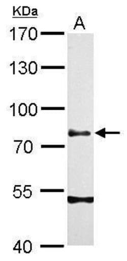 Invitrogen Chromogranin C Polyclonal Antibody 100 &mu;L; Unconjugated:Antikörper
