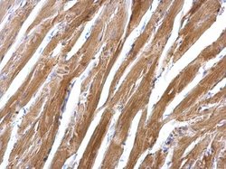 Invitrogen SGCE Polyclonal Antibody 100 &mu;L; Unconjugated:Antibodies,