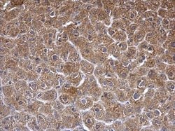 Invitrogen SGCE Polyclonal Antibody 100 &mu;L; Unconjugated:Antibodies,