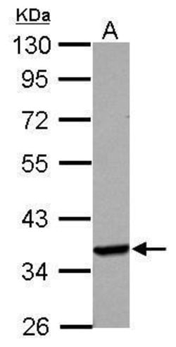 Invitrogen Langerin Polyclonal Antibody 100 &mu;L; Unconjugated:Antibodies,