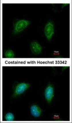 Invitrogen C2CD2 Polyclonal Antibody 100 &mu;L; Unconjugated:Anticuerpos