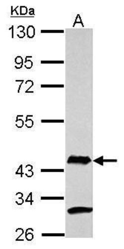 Invitrogen AIM2 Polyclonal Antibody 100 &mu;L | Buy Online | Invitrogen&trade; | Fisher Scientific