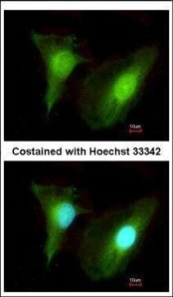 Invitrogen SMYD2 Polyclonal Antibody 100 &mu;L; Unconjugated:Antibodies,