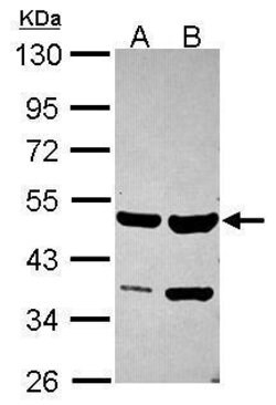 Invitrogen SMYD2 Polyclonal Antibody 100 &mu;L; Unconjugated:Antibodies,