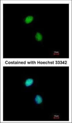 Invitrogen POLE3 Polyclonal Antibody 100 &mu;L | Buy Online | Invitrogen&trade; | Fisher Scientific