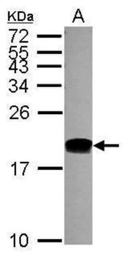 Invitrogen POLE3 Polyclonal Antibody 100 &mu;L | Buy Online | Invitrogen&trade; | Fisher Scientific