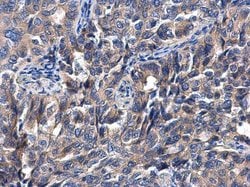 Invitrogen P4HTM Polyclonal Antibody 100 &mu;L; Unconjugated:Antibodies,