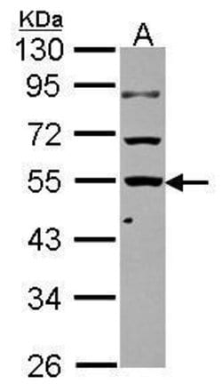 Invitrogen KLHDC4 Polyclonal Antibody 100 &mu;L; Unconjugated:Antibodies,