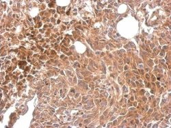 Invitrogen MKS1 Polyclonal Antibody 100 &mu;L; Unconjugated:Antibodies,