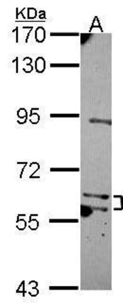 Invitrogen MKS1 Polyclonal Antibody 100 &mu;L; Unconjugated:Antibodies,