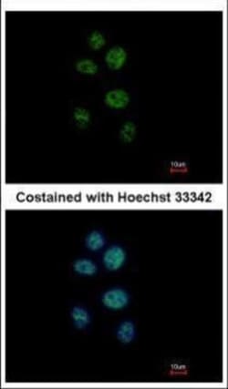Invitrogen ZNF83 Polyclonal Antibody 100 &mu;L | Buy Online | Invitrogen&trade; | Fisher Scientific