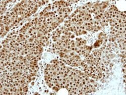 Invitrogen ZNF83 Polyclonal Antibody 100 &mu;L | Buy Online | Invitrogen&trade; | Fisher Scientific