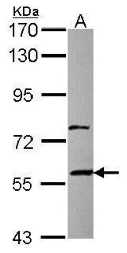 Invitrogen ZNF83 Polyclonal Antibody 100 &mu;L | Buy Online | Invitrogen&trade; | Fisher Scientific
