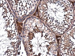 Invitrogen PPP2R2D Polyclonal Antibody 100 &mu;L | Buy Online | Invitrogen&trade; | Fisher Scientific