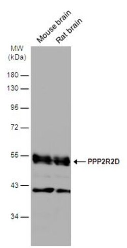 Invitrogen PPP2R2D Polyclonal Antibody 100 &mu;L | Buy Online | Invitrogen&trade; | Fisher Scientific