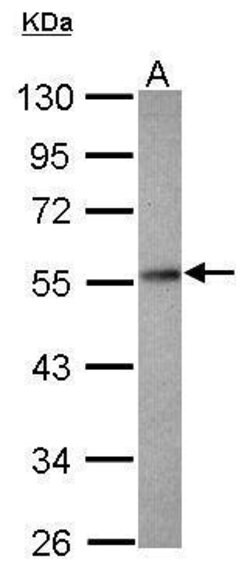 Invitrogen PPP2R2D Polyclonal Antibody 100 &mu;L | Buy Online | Invitrogen&trade; | Fisher Scientific