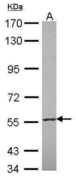 Invitrogen RNF23 Polyclonal Antibody 100 &mu;L; Unconjugated:Antibodies,