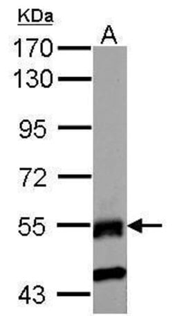Invitrogen RNF23 Polyclonal Antibody 100 &mu;L; Unconjugated:Antibodies,