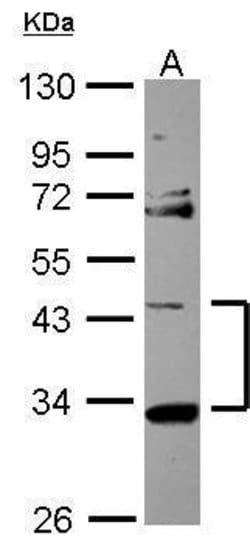 Invitrogen STARD7 Polyclonal Antibody 100 &mu;L; Unconjugated:Antibodies,