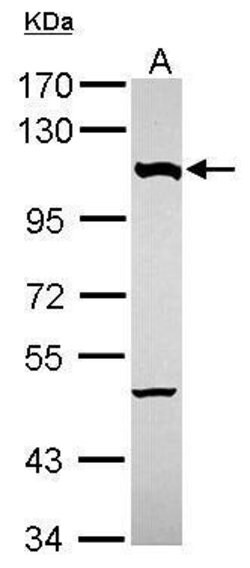 Invitrogen NUP107 Polyclonal Antibody 100 &mu;L; Unconjugated:Antibodies,