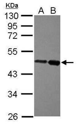 Invitrogen ZBTB26 Polyclonal Antibody 100 μL; Unconjugated:Antibodies,