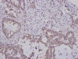 Invitrogen GBA3 Polyclonal Antibody 100 &mu;L; Unconjugated:Antibodies,