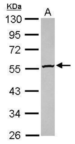 Invitrogen GBA3 Polyclonal Antibody 100 &mu;L; Unconjugated:Antibodies,
