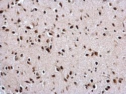 Invitrogen PTBP2 Polyclonal Antibody 100 &mu;L; Unconjugated:Antibodies,