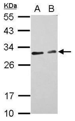 Invitrogen CIDEC Polyclonal Antibody 100 &mu;L; Unconjugated:Antibodies,