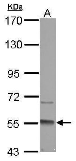 Invitrogen GMCL1 Polyclonal Antibody 100 &mu;L; Unconjugated:Antibodies,