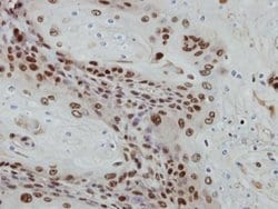 Invitrogen POLR1E Polyclonal Antibody 100 &mu;L; Unconjugated:Antibodies,