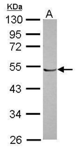 Invitrogen POLR1E Polyclonal Antibody 100 &mu;L; Unconjugated:Antibodies,