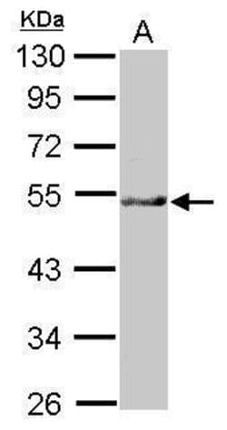 Invitrogen NARFL Polyclonal Antibody 100 &mu;L | Buy Online | Invitrogen&trade; | Fisher Scientific