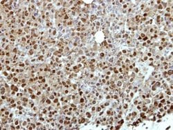 Invitrogen ZNF426 Polyclonal Antibody 100 &mu;L; Unconjugated:Antibodies,