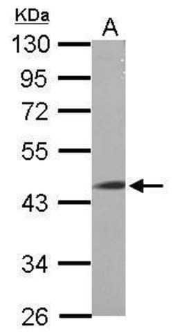 Invitrogen LRRC2 Polyclonal Antibody 100 &mu;L; Unconjugated:Antibodies,