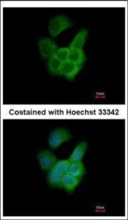 Invitrogen RPAP3 Polyclonal Antibody 100 &mu;L; Unconjugated:Antibodies,
