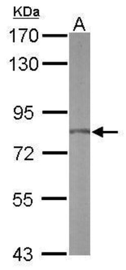 RPAP3 Polyclonal Antibody, Invitrogen 100 &mu;L; Unconjugated:Antibodies,