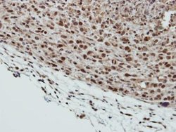 Invitrogen SMC6 Polyclonal Antibody 100 &mu;L | Buy Online | Invitrogen&trade; | Fisher Scientific