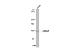 Invitrogen SMC6 Polyclonal Antibody 100 &mu;L | Buy Online | Invitrogen&trade; | Fisher Scientific