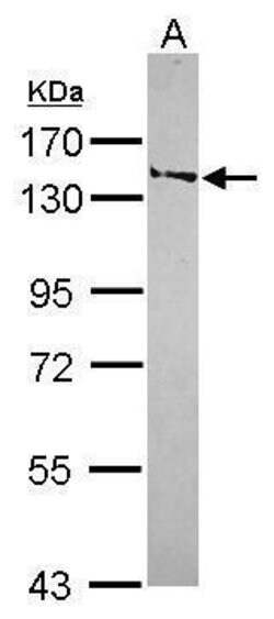 Invitrogen SMC6 Polyclonal Antibody 100 &mu;L | Buy Online | Invitrogen&trade; | Fisher Scientific