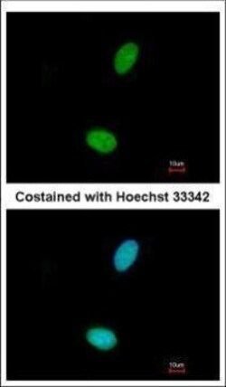 Invitrogen ZNF408 Polyclonal Antibody 100 &mu;L; Unconjugated:Antibodies,
